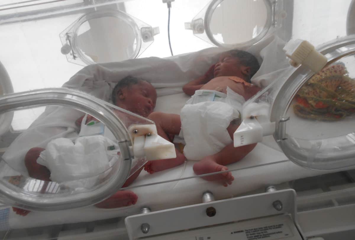 Die Zwillinge, als sie direkt nach der Geburt in der Neontatologie betreut wurden